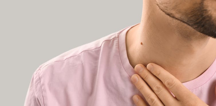Man with a mole on his neck